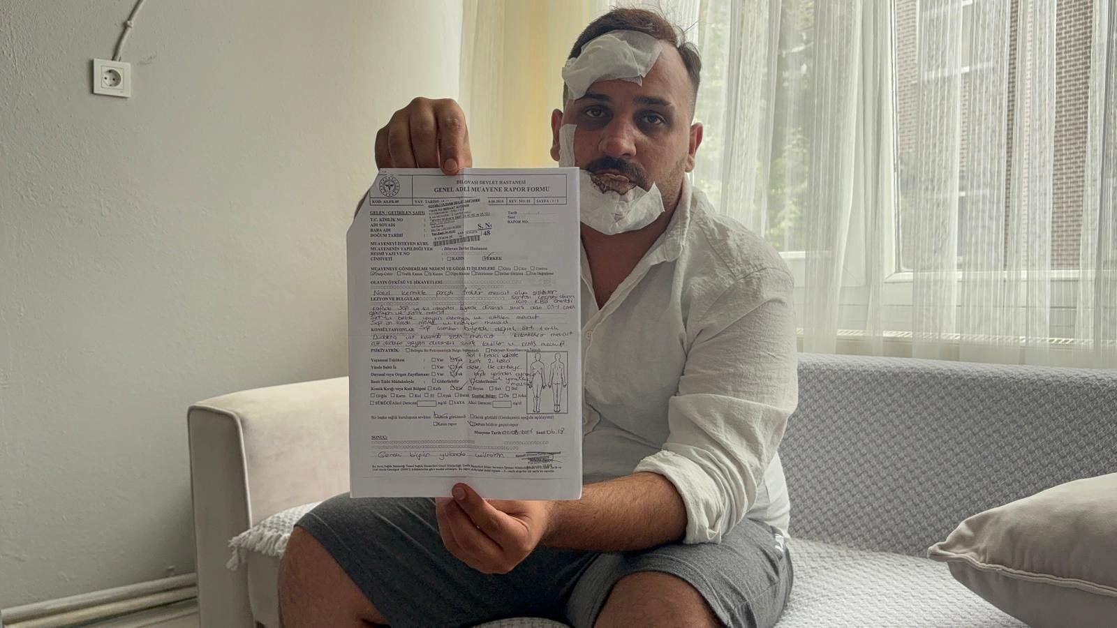 Taksici Şikayeti: Eski Sözlü, İkiz ve Polisler Dövdü