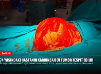 74 Yaşındaki Hastanın Karnında Dev Tümör Tespit Edildi