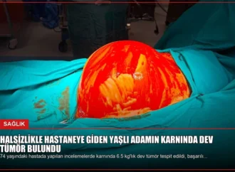 Halsizlikle Hastaneye Giden Yaşlı Adamın Karnında Dev Tümör Bulundu