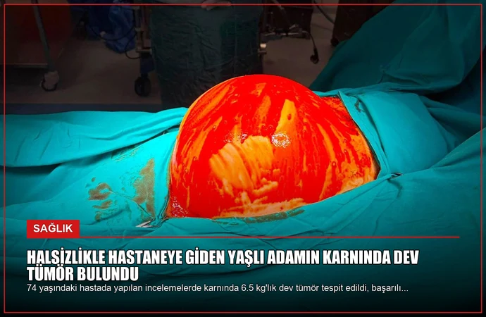 Halsizlikle Hastaneye Giden Yaşlı Adamın Karnında Dev Tümör Bulundu
