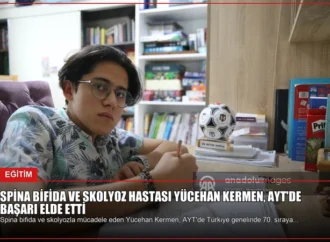 Spina Bifida ve Skolyoz Hastası Yücehan Kermen, AYT’de Başarı Elde Etti