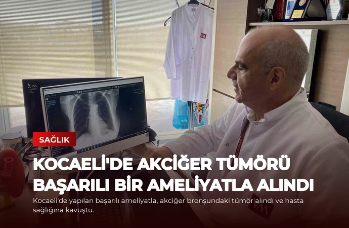 Kocaeli’de Akciğer Tümörü Başarılı Bir Ameliyatla Alındı