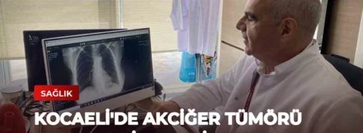 Kocaeli’de Akciğer Tümörü Başarılı Bir Ameliyatla Alındı