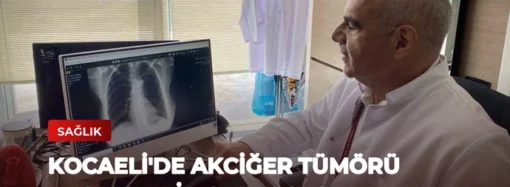 Kocaeli’de Akciğer Tümörü Başarılı Bir Operasyonla Alındı