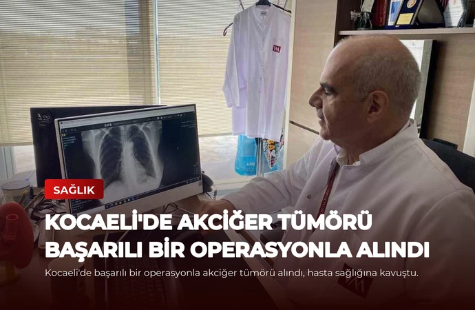 Kocaeli’de Akciğer Tümörü Başarılı Bir Operasyonla Alındı